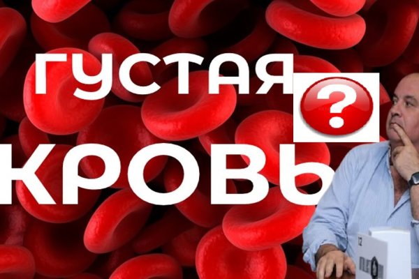 Кракен клирнет